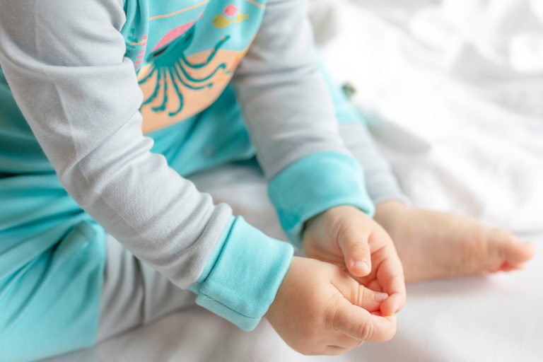 Neurodermitis_Baby_Kleidung_Hautvertraeglich_Bio_Juckreiz_lindern_Ekzem_Babypflege_kratzschutz_Hypoallergen